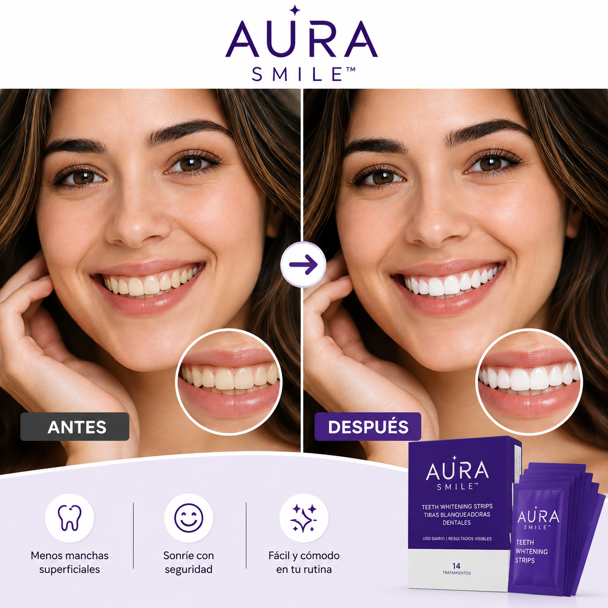 AuraSmile™ La sonrisa que transmite confianza.